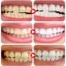 2 Pcs Sp-6 Fresh Breath Toothpaste Sp-6 Toothpaste Sp-6 Probiotic Toothpaste Probiotic Toothpaste Fresh Breath Toothpaste Removes Stains Complete Dental Care - Buy Online on GoSupps.com