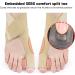 Bordstract Toe Spreader Socks for Bale Toe Relief - Non-Slip Breathable Comfort - Skin Color Right Size - Buy Online on GoSupps.com