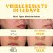 DERMACENTRIC 14-Day Vita Facial Ampoule Vegan Korean Skincare Serum with Niacinamide & Glutathione for Radiant Balanced-Looking Skin (1.01 fl oz) - Buy Online on GoSupps.com