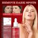 KERANEET Niacinamide Serum Face Serum Niacinamide Serum Face Serum Moisturising Serum Face Serum Suitable for Use Day and Night - Buy Online on GoSupps.com