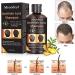 Anti-Hair Loss Shampoo 220mL - Effective Hair Growth Solution for Thinning & Breakage - Stop Hair Loss & Promote Fast Growth - Men & Women Treatment - Buy Online on GoSupps.com