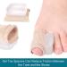 1Pcs Gel Toe Separator Spacer - Bunion Corrector for Hallux Valgus Overlapping Toes Blisters & Corns - Comfort & Relief - Buy Online on GoSupps.com