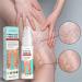 Shantou Youjia 30 ml sparicose veins cream spider veins removal cream cream against spider veins gentle leg care for a good feeling in the legs leg care ointment improve blood circulation for legs - Buy Online on GoSupps.com