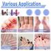 Mesee 60-Piece Sanding Bands for Nail Drill - 4 Colors - Coarse to Fine Grit - Efile Sand Set for Acrylic Nails - Manicures & Pedicures - Buy Online on GoSupps.com