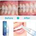 Gums Therapy Gel & Tooth Whitening Kit | 3-Piece Sensitive Teeth Solution - Buy Online on GoSupps.com