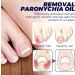  LWuuywa German Toenailplus Anti-Paronychia Relief Oil 10ml Correction Treatment Oil Nail Care Nail Growing Anti-Paronychia Aid Oil Ingrown Nail Drops - Buy Online on GoSupps.com