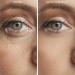 Expression Line Smoothing Forehead Patch | Medical-Grade Silicone for Anti-Aging & Overnight Wrinkle Reduction | 20X Reusable Beautify Brow Lift - Buy Online on GoSupps.com