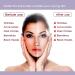 Nutriglow Platinum Diamond Gold and Pearl Facial Kit 6-Pieces Skin Care Kit for Women 250 Gm+10Ml - Buy Online on GoSupps.com