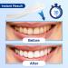 Sensitivity-Friendly Teeth Whitening Strips | 28 Effective Whitener Strips for Reduced Sensitivity | Removes Stains from Smoking, Coffee, Soda, & Wine | 14 Treatments - Buy Online on GoSupps.com