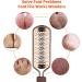 Foot File Professional Pedicure Stainless Steel Detachable Foot Scrubber Callus Remover for feet Foot Scraper Corns Callous Hard Skin Removers Pedicure Rasp for Wet and Dry Feet(Golden) - Buy Online on GoSupps.com