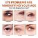 Propolis Moisture Firming Eye Cream - Anti-Wrinkle Hydrating Anti-Aging Renewal for Bags & Lifting (1PC) - Ships Internationally - Buy Online on GoSupps.com
