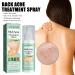 Back Acne Treatment Spray - Salicylic Acid & Tea Tree Oil Solution for Body Acne - 2PCS - Buy Online on GoSupps.com