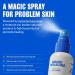 Magic Molecule Hypochlorous Acid Spray for Breakout-Prone Skin Eczema & Itchy Rashes | Helps 50+ Dermal Issues | Safe for Multiple Daily Uses | For All Skin Types | 8 oz Spray 8 Fl Oz (Pack of 1) - Buy Online on GoSupps.com