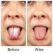 3 Pcs Stainless Steel Tongue Scraper Set - Oral Care Metal Tongue Cleaner for Fresher Breath - Adults & Kids - Buy Online on GoSupps.com