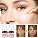 Whitening & Freckle Removing Essence - 30ml Anti-Spot Face Serum 3Pcs | Vitamin C Melasma Removal & Blemish Treatment - Buy Online on GoSupps.com