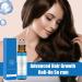 Hair Growth Oil 10ml Stimulating Hair Root Roll-on Oil - Non-Greasy Nourishing Thickening Treatment for Men and Women - Buy Online on GoSupps.com