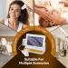 Skin Diagnosis Analyseur de cheveux 11 " avec double t te 50 x / 200 x pour la maison le salon de beaut et le spa white - Buy Online on GoSupps.com