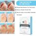 Wart Remover Plasters for Hands & Feet - Corn & Verruca Removal - Plantar Warts & Callus Treatment - 24pcs - Buy Online on GoSupps.com
