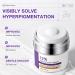 12% Azelaic Acid Facial Cream with Niacinamide & Hyaluronic Acid - Brightening & Texture Smoothing Face Cream Gentle Daily Skincare for Dull & Acne-Prone Skin 50g/1.69 oz - Buy Online on GoSupps.com