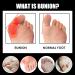 ERGOic Bunion Relief Socks - Anti-Bunion Health Socks for Women and Men - Bunion Corrector Toe Align Socks (Black 5 Pairs) - Buy Online on GoSupps.com