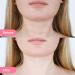 Dr. Pure Face Massager - Double Chin Remover & Neck Sculpting Tool | Portable Facial Beauty Tool for Skin Tightening, Firming, and Smoothing - White - Buy Online on GoSupps.com