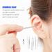 RTLR Stainless Steel Ear Wax Remover Kit | Spoon Shaped with Comfortable Handle - Home & Travel - Buy Online on GoSupps.com