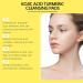 Kojic & Turmeric Cleansing Pads Exfoliator Unclog Pores Turmeric Cleansing Pads Balances Skin Oil and Water Resurfacing Pads for Face & Body Facial Sponges for Cleansing - Buy Online on GoSupps.com