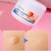 Wart Remover Cream Fast Acting Ointment Anti Corn Cream for Warts Plantar Warts Common Warts Flat Warts Warts for Feet Toe Finger Hands - Buy Online on GoSupps.com