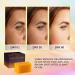 VALITIC Kojic Acid Soap for Hyperpigmentation - Glutathione, Collagen & Vitamin C - Turmeric & Japanese Complex for Dark Spot Correction - 2 Pack - Buy Online on GoSupps.com