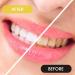 Prasacco 25-Piece Interdental Brushes | L-Shaped 0.6 mm Portable Oral Care Brushes | Non-Slip Handle for Effective Tooth Cleaning (Yellow) - Buy Online on GoSupps.com