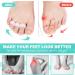 ERGOfoot Hammer Toe Corrector 4 PCS - Toe Straightener & Separator Loops for Foot Pain Relief - Men and Women - 2 Pairs - Buy Online on GoSupps.com
