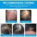 Professional Quality Hair Fibres Hair Fibres Light Brown for Thinning Hair Completely Conceals Hair Loss in 15 Seconds Undetectable & Natural Hair Loss Product for Women and Men (Light Brown) - Buy Online on GoSupps.com
