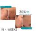 FactorFive Regenerative Serum with Stem Cell Growth Factors for Skin Tightening & Smoothing | Wrinkle & Pore Reduction | Rejuvenation - 1 fl oz - Buy Online on GoSupps.com