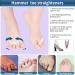 DYKOOK Hammer Toe Straightener Set - 6 PCS Toe Corrector Gels for Crooked Toes | 3 Loop Design for Joint Realignment | Gel Splints for Cushion Support - Buy Online on GoSupps.com