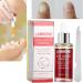 Nail Repair Essence 12ML - Powerful Anti-Fungus Treatment for Healthy Nails - Buy Online on GoSupps.com