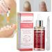 Nail Repair Essence 12ml - Natural Anti-fungus Treatment for Effective Nail Repair - Buy Online on GoSupps.com