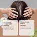  SUYOIKHGMN 3-in-1 nourishing shampoo with rosemary and onion richly moisturizes reduces hair loss strengthens roots and adds shine. Suitable for men and women. - Buy Online on GoSupps.com