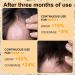 Buy Hair Growth Foam for Men & Women | With Biotin & Capilia Longa | Effective Hair Regrowth Treatment for Thicker Stronger Hair | Stop Hair Thinning - Buy Online on GoSupps.com