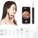 Earwax Cleaner Wireless Ear Otoscope 1080P FHD Ear Wax Removal Tool for Kids Adults Pets