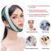 Adjustable Anti-Snoring Chin Strap for Women - Stop Snoring with NXKIDR Chin Strap for Sleeping - Buy Online on GoSupps.com