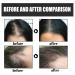 Hair Thickening Fiber Powder - 12g Hair Building Fibers for Men & Women | Instant Hair Loss Concealer & Fuller Look | Natural Black - Buy Online on GoSupps.com