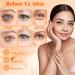 Under Eye Patches - 60 Pcs | Hyaluronic Acid & Collagen | Dark Circles, Wrinkles & Puffiness Treatment - Buy Online on GoSupps.com