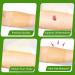 MarvellHealth Honey Impregnated Gauze Dressing 4x4 - Pack of 10 | Sterile Pads with Active Leptospermum Honey for Fast Healing of Diabetic Ulcers & Burns - Buy Online on GoSupps.com