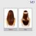 MD Revitalizing Shampoo and Conditioner - Nourish & Revive | 11 fl oz - International Shipping Available - Buy Online on GoSupps.com