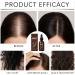 Scalp Oil For Hair Growth30ml Volume Solution Hair Strengthening Oil For Volume Scalp Care Frizz Control Strengthening Women Men Home & Travel - Buy Online on GoSupps.com