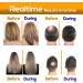 Biotin DHT Blocker Anti Dandruff Hair Growth Shampoo - 473ml | For Dry, Itchy Scalp, Hair Thinning & Dermatitis | Hair Loss Treatment for Women & Men - Buy Online on GoSupps.com