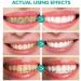 Herbal Brightening Oral Repair Foam & Gum Health Mouthwash - Teeth Whitening & Calculus Removal (2 Pcs) | International Shipping - Buy Online on GoSupps.com