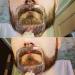 Beard Shaping Tool Set for Men - Transparent - 5 PCS Grooming Template for Goatee, Mustache, Face Hair Styling - Buy Online on GoSupps.com