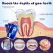5D Teeth Whitening Strips Kit - Safe Effective Home Tooth Bleaching for Bright White Smiles - Buy Online on GoSupps.com
