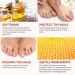 Extra Strength Toe Nail Fungus Treatment - Nail Repair Solution for Damaged Nails - Buy Online on GoSupps.com